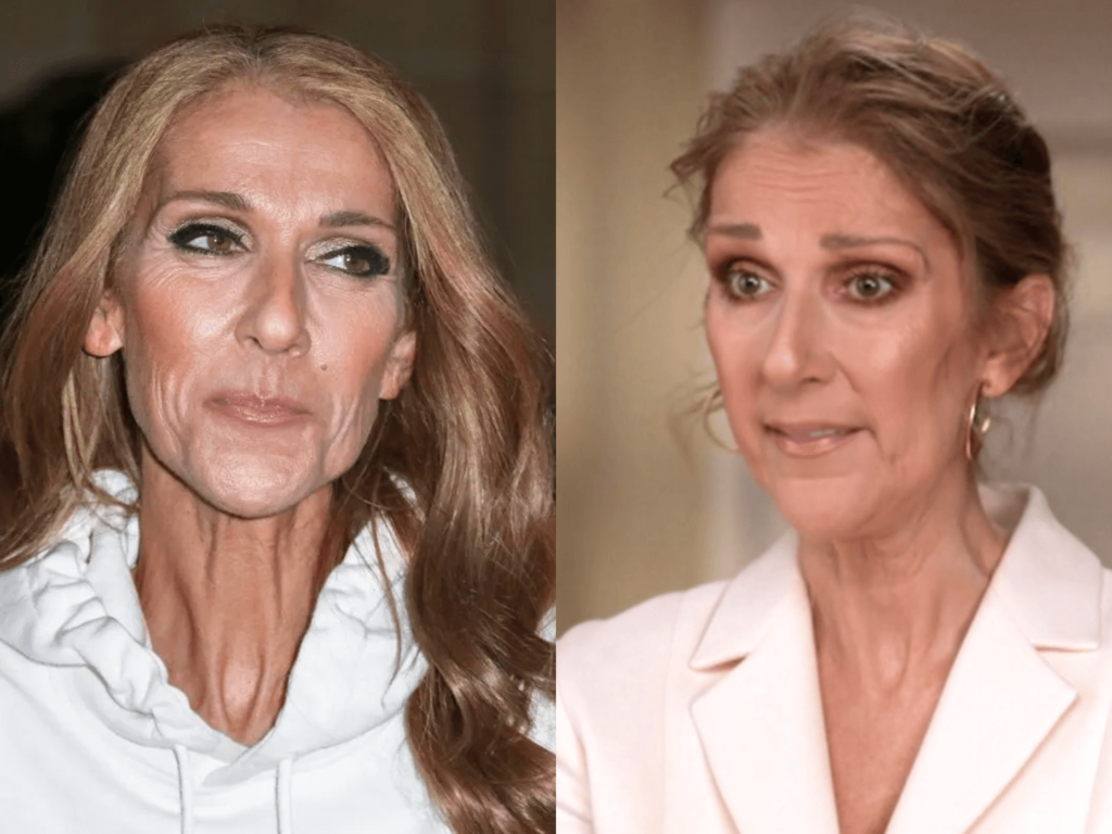 Celine Dion Krankheit